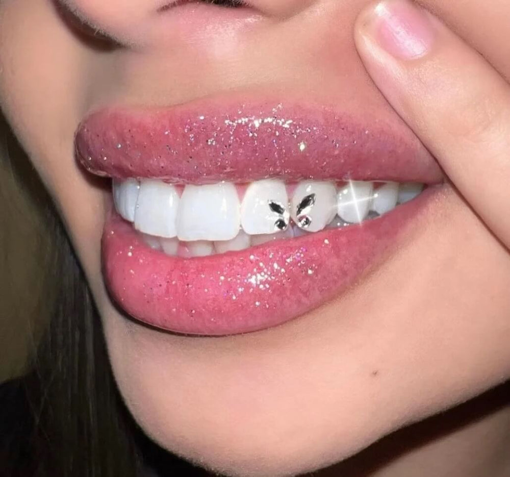 Beautiful smile showing multiple tooth gems